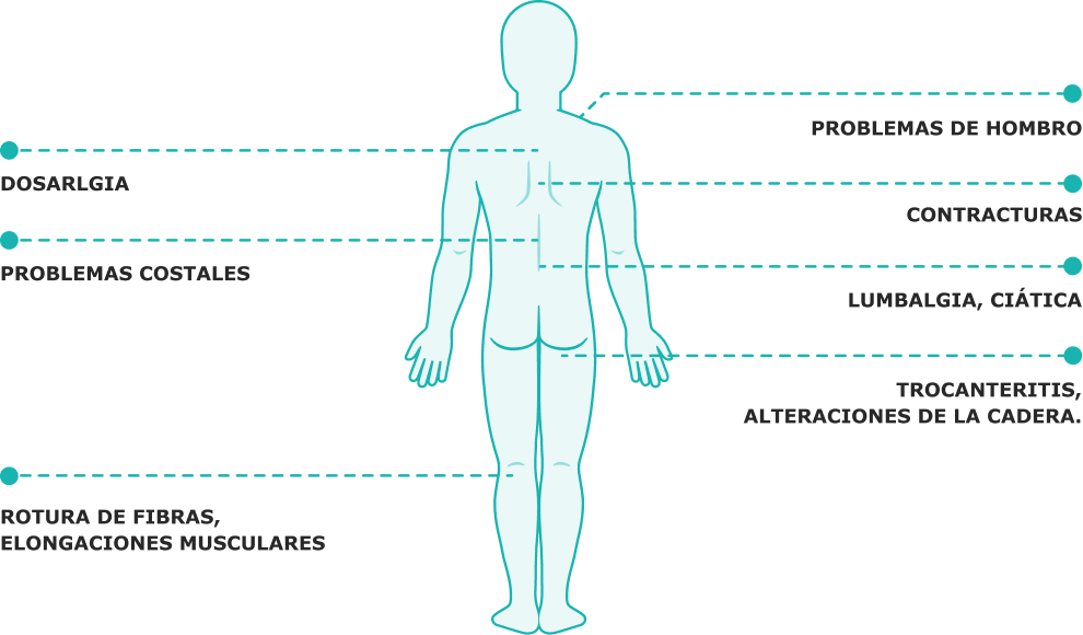 Grafismo cuerpo humano con numeración de problemas que soluciona la fisioterapia