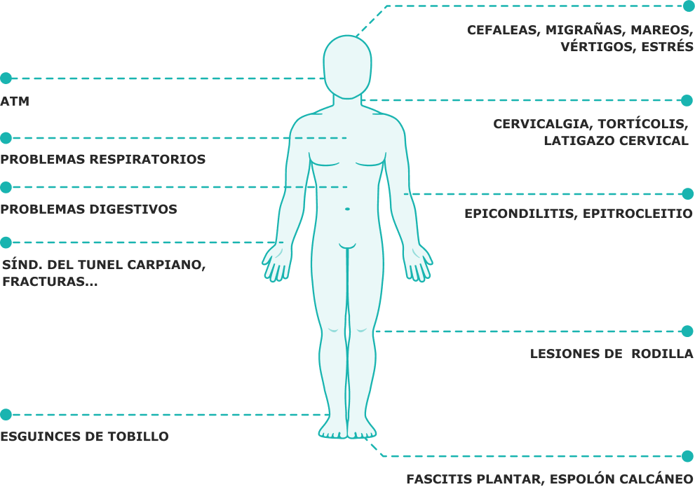 Grafismo cuerpo humano con numeración de problemas que soluciona la fisioterapia